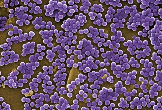 耐甲氧西林金黄色葡萄球菌的细菌