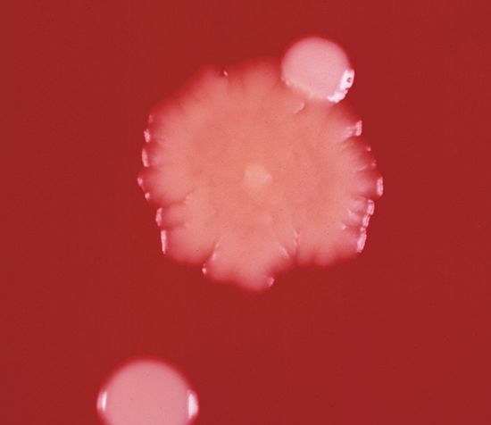 白色葡萄球菌白色:乳酸菌、葡萄球菌